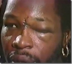mitch-green-eye