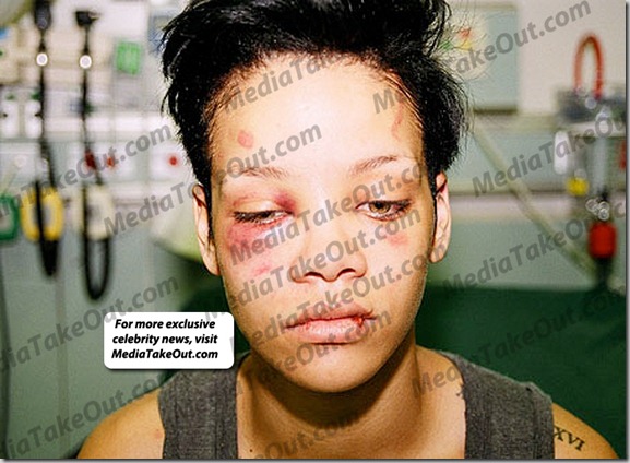 rhianna-beaten